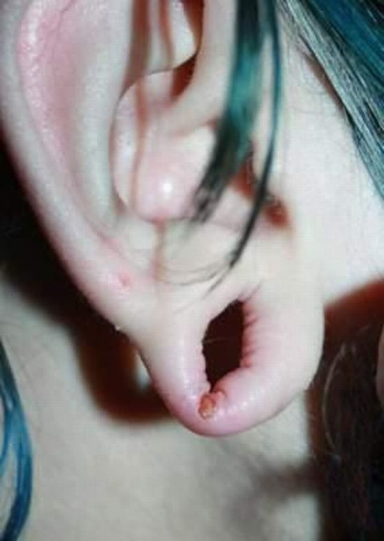 What causes bad piercing. Not for sensitive souls! - 41