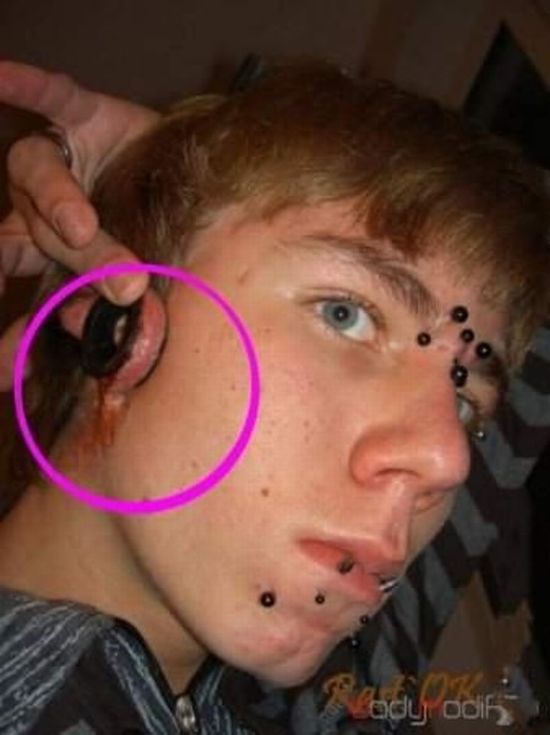 What causes bad piercing. Not for sensitive souls! - 47