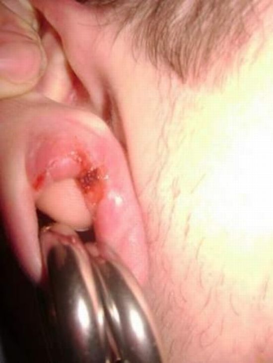 What causes bad piercing. Not for sensitive souls! - 48