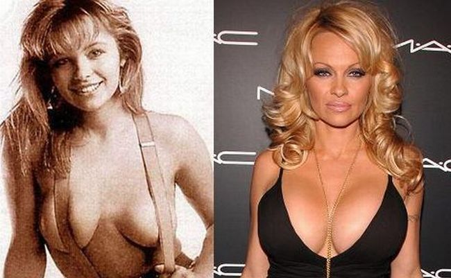 Stars before and after breast job - 03