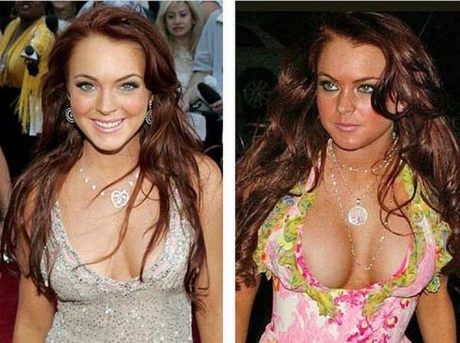 Stars before and after breast job - 04