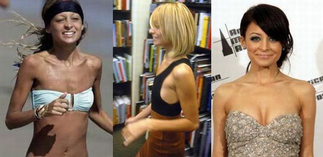 Stars before and after breast job - 14
