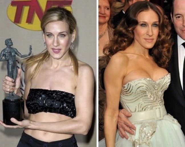 Stars before and after breast job - 16