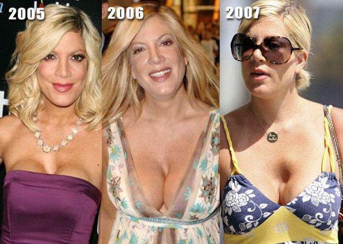 Stars before and after breast job - 18