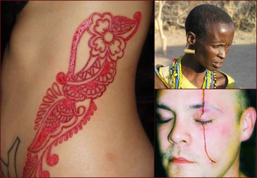 Scarring, a very weird way to “decorate” your body - 5