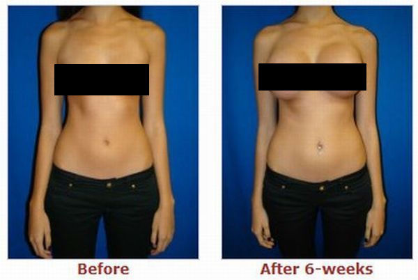 Before and after plastic surgery (74 pics) Before and after plastic surgery (74 pics)