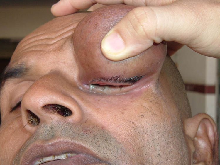 OMG of the day! Awful bump above the man’s eye - 03