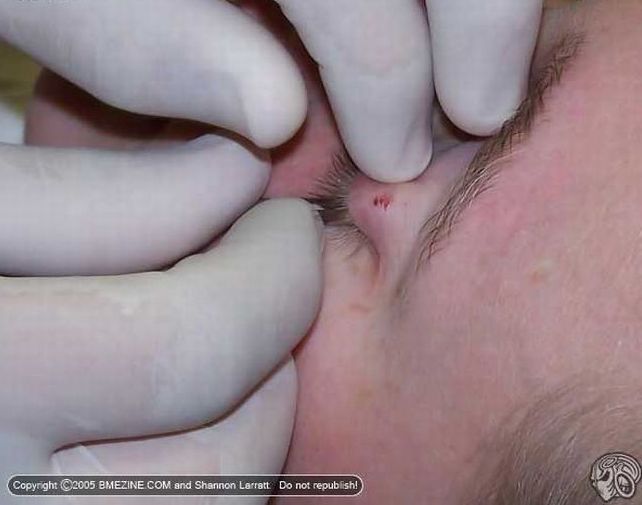 Another crazy body modification – the piercing of the century - 01
