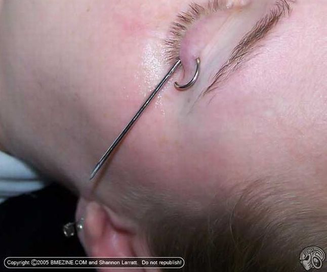 Another crazy body modification – the piercing of the century - 02