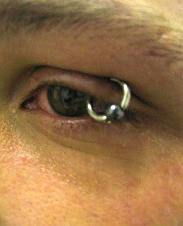 Another crazy body modification – the piercing of the century - 15