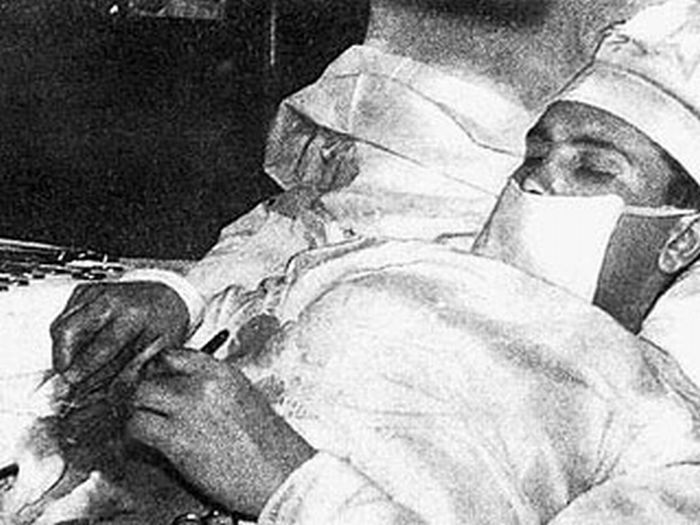 Amazing operation of surgeon Leonid Rogozov - 02