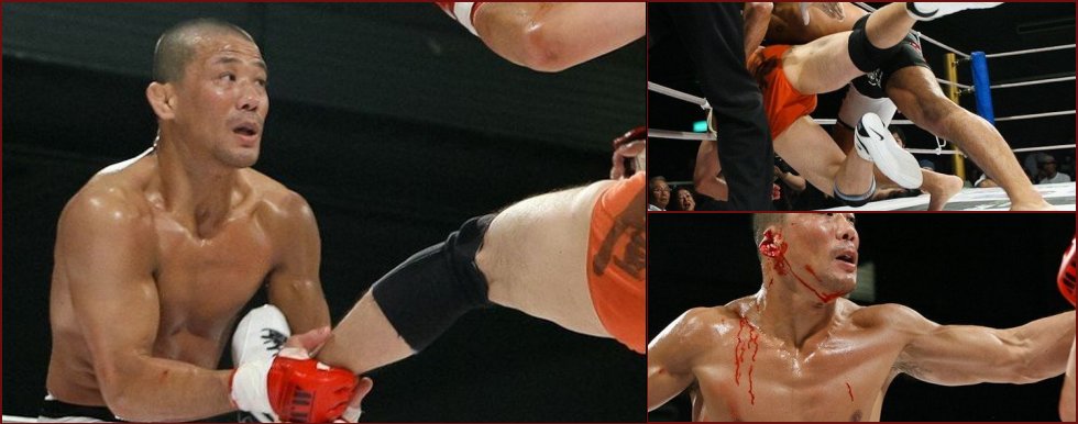Following in the footsteps of Mike Tyson: Fighter J-Taro bit off an opponent's ear - 7