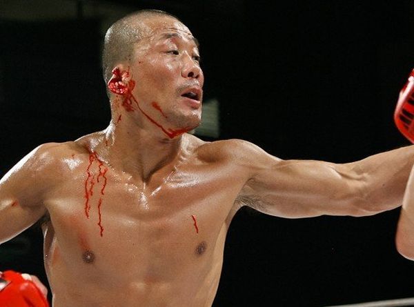 Following in the footsteps of Mike Tyson: Fighter J-Taro bit off an opponent's ear - 03