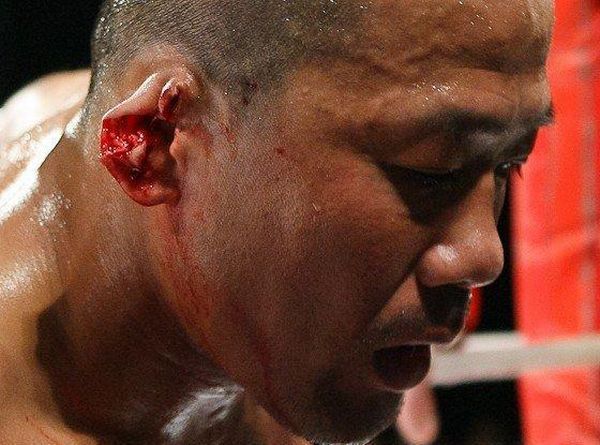 Following in the footsteps of Mike Tyson: Fighter J-Taro bit off an opponent's ear - 04
