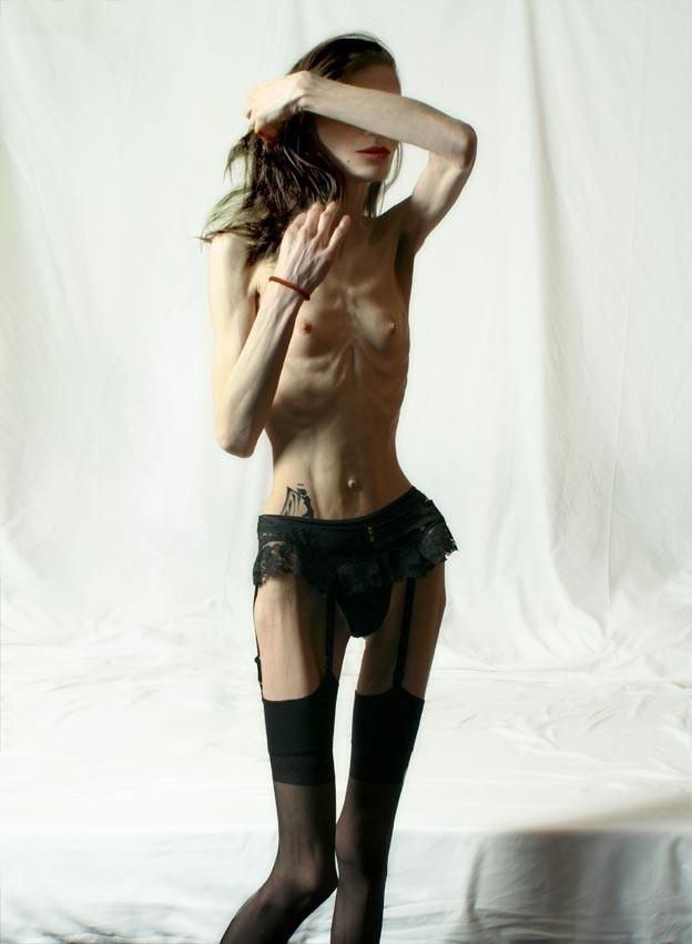 Anorexia - beauty that scares - 13