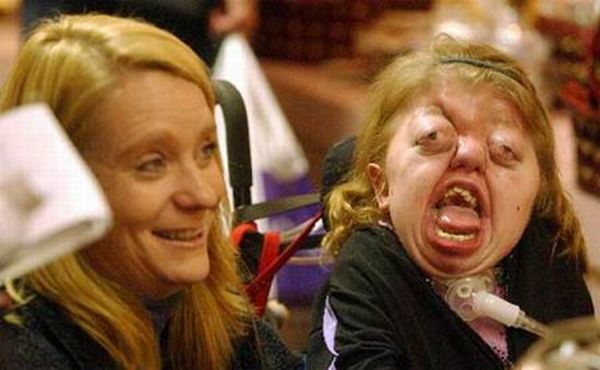 People with terrible physical deformities - 20
