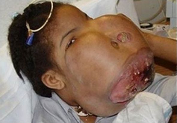 People with terrible physical deformities - 22