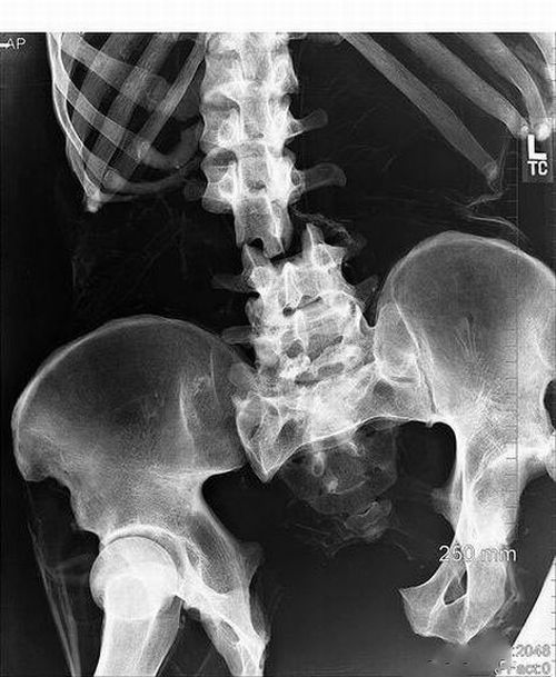 A selection of the most bizarre X-ray images - 03
