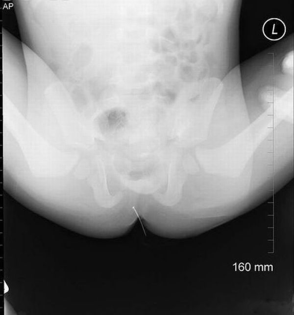 A selection of the most bizarre X-ray images - 05