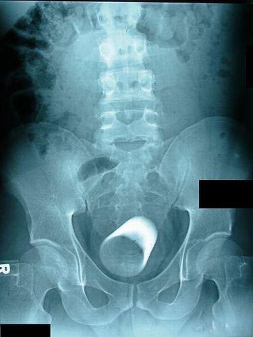 A selection of the most bizarre X-ray images - 06