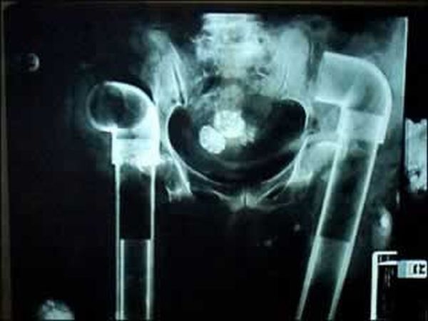 A selection of the most bizarre X-ray images - 11