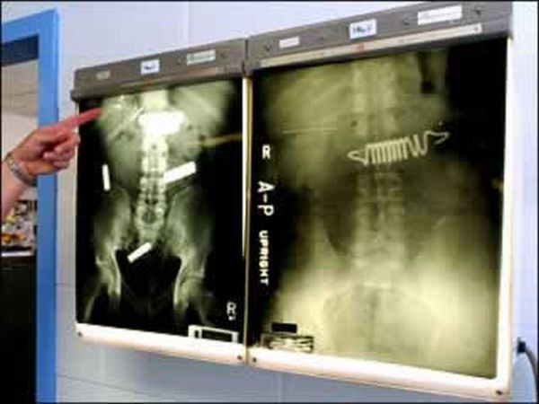 A selection of the most bizarre X-ray images - 16