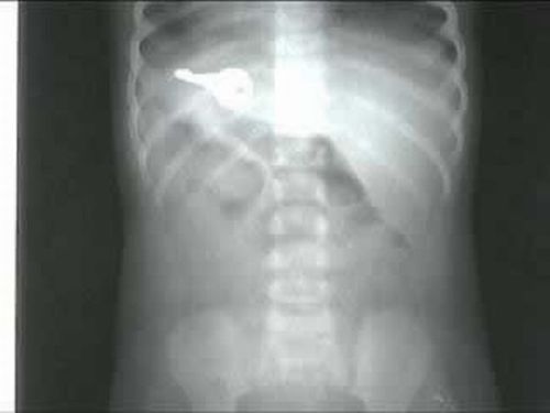 A selection of the most bizarre X-ray images - 19