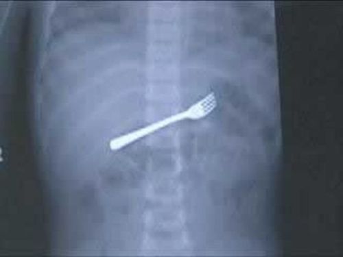 A selection of the most bizarre X-ray images - 20