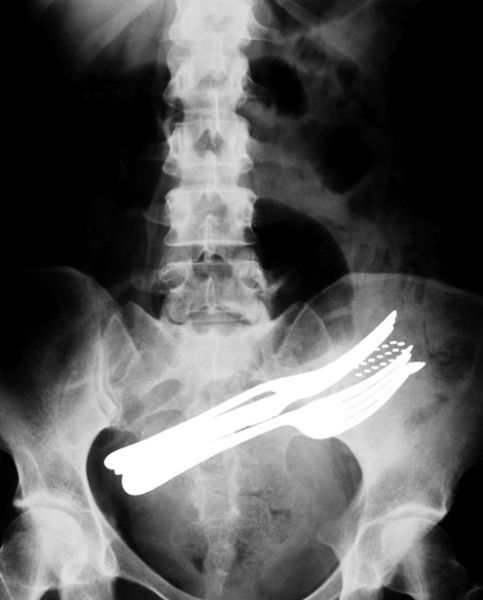 A selection of the most bizarre X-ray images - 21