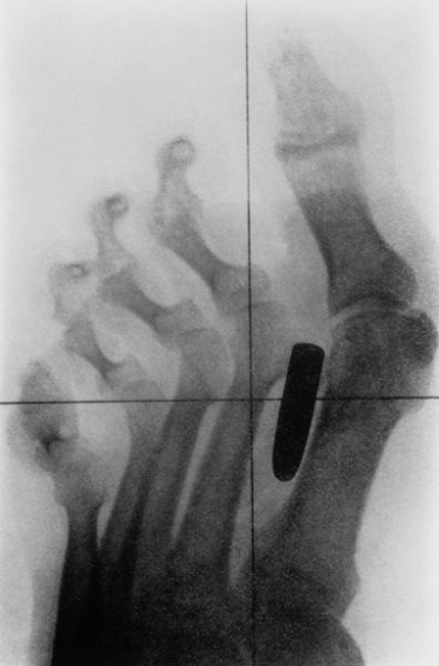A selection of the most bizarre X-ray images - 23