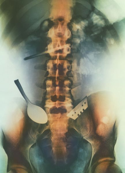 A selection of the most bizarre X-ray images - 25