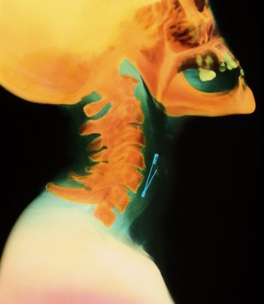 A selection of the most bizarre X-ray images - 26