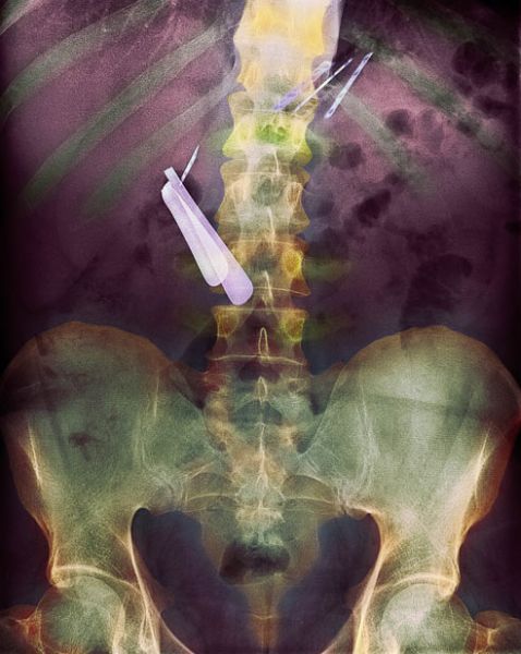 A selection of the most bizarre X-ray images - 28