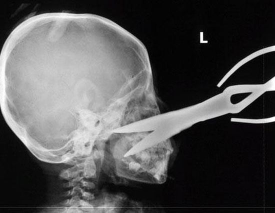 Another compilation of horrific X-Ray pictures - 08