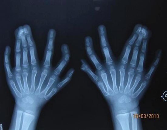 Another compilation of horrific X-Ray pictures - 09