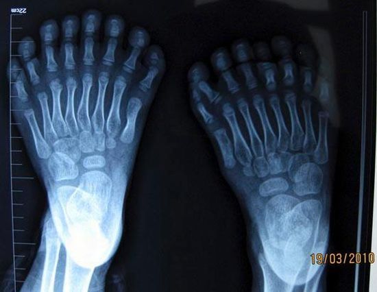 Another compilation of horrific X-Ray pictures - 10