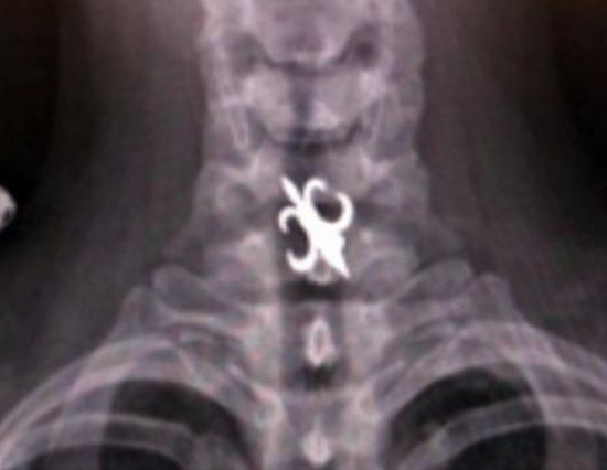 Another compilation of horrific X-Ray pictures - 12